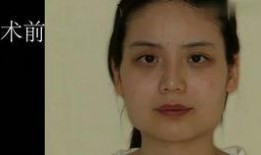 明星医美爆料视频,独家爆料视频深度解析